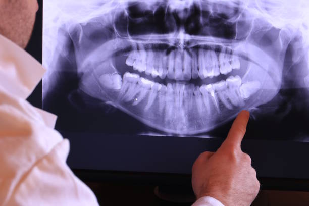 Best Weekend Emergency Dentist in Rye Brook, NY